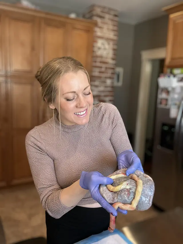 Emily professionally handling a placenta